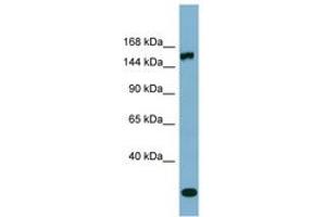 Image no. 1 for anti-Glutamyl-Prolyl-tRNA Synthetase (EPRS) (AA 971-1020) antibody (ABIN6741867) (EPRS anticorps  (AA 971-1020))