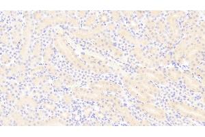 Detection of PDGF BB in Mouse Kidney Tissue using Polyclonal Antibody to Platelet Derived Growth Factor BB (PDGF BB) (PDGF-BB Homodimer (AA 21-241) anticorps)