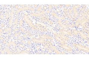 Detection of PDGF BB in Mouse Kidney Tissue using Polyclonal Antibody to Platelet Derived Growth Factor BB (PDGF BB) (PDGF-BB Homodimer (AA 21-241) anticorps)