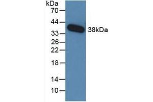 Detection of Recombinant TGFb3, Human using Monoclonal Antibody to Transforming Growth Factor Beta 3 (TGFb3)