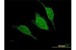 Immunofluorescence of purified MaxPab antibody to ACADM on HeLa cell. (Medium-Chain Specific Acyl-CoA Dehydrogenase, Mitochondrial (MCAD) (AA 1-421) anticorps)