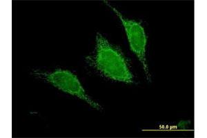 Immunofluorescence of purified MaxPab antibody to ACADM on HeLa cell. (Medium-Chain Specific Acyl-CoA Dehydrogenase, Mitochondrial (AA 1-421) anticorps)