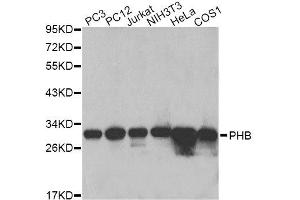 Western blot analysis of extracts of various cell lines, using PHB antibody.