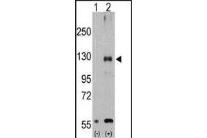 Western blot analysis of TR (arrow) using rabbit polyclonal TR Antibody (Center ) (ABIN392820 and ABIN2842252). (TRPM8 anticorps  (AA 521-552))