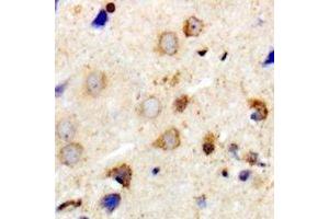 Immunohistochemical analysis of MYPT1 staining in human brain formalin fixed paraffin embedded tissue section. (PPP1R12A anticorps)