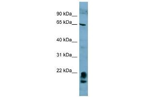 FAM134A antibody used at 1 ug/ml to detect target protein.