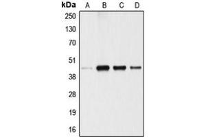 Western blot analysis of ANGPTL4 expression in A549 (A), 293T (B), U87MG (C), SGC (D) whole cell lysates. (ANGPTL4 anticorps  (Center))