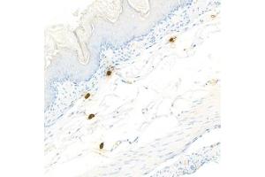 Immunohistochemistry analysis of paraffin-embedded mouseskinusing Chymase (ABIN7073506) at dilution of 1:1000 (CMA1 anticorps)