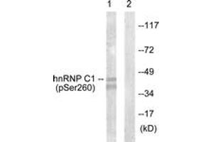Western blot analysis of extracts from 293 cells treated with H2O2 100uM 15', using hnRNP C1/2 (Phospho-Ser260) Antibody. (HNRNPC anticorps  (pSer260))