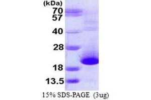 SDS-PAGE (SDS) image for Prefoldin Subunit 5 (PFDN5) (AA 1-154) protein (His tag) (ABIN667517)