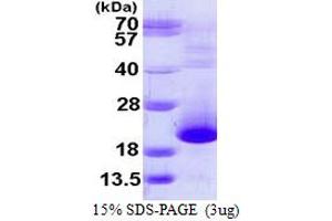 SDS-PAGE (SDS) image for Prefoldin Subunit 5 (PFDN5) (AA 1-154) protein (His tag) (ABIN667517) (PFDN5 Protein (AA 1-154) (His tag))