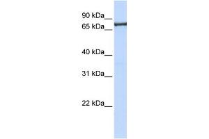 WB Suggested Anti-TNPO2 Antibody Titration: 0. (TNPO2 anticorps  (C-Term))