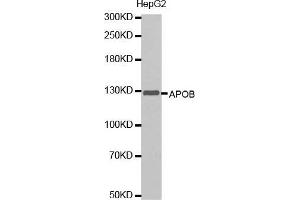 Western blot analysis of extracts of HepG2 cells lines, using APOB antibody. (APOB anticorps  (AA 28-330))