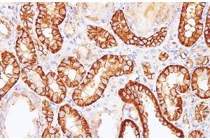 Immunohistochemistry of paraffin-embedded Rat kidney using Sptan1 Polyclonal Antibody at dilution of 1:100(400x)