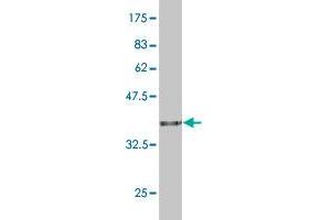 Western Blot detection against Immunogen (36.