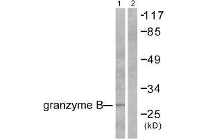 Western blot analysis of extracts from NIH/3T3 cells, using Granzyme B antibody (ABIN2843546). (GZMB anticorps  (N-Term))