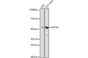 Western blot analysis of extracts of various cell lines, using (ABIN6130229, ABIN6143029, ABIN6143030 and ABIN6217868) at 1:1000 dilution. (Keratin 36 anticorps  (AA 388-467))