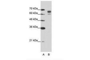 Image no. 2 for anti-DEAD (Asp-Glu-Ala-Asp) Box Polypeptide 17 (DDX17) (AA 570-619) antibody (ABIN203205) (DDX17 anticorps  (AA 570-619))