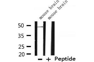 Western blot analysis of extracts from mouse brain, using TMPRSS3 Antibody.