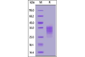 Biotinylated Human CD79B, His,Avitag on  under reducing (R) condition. (CD79b Protein (AA 29-159) (His tag,AVI tag,Biotin))