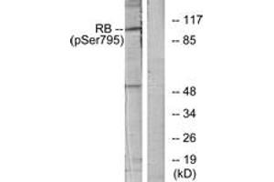 Western blot analysis of extracts from K562 cells treated with serum 10%, using Retinoblastoma (Phospho-Ser795) Antibody. (Retinoblastoma Protein (Rb) anticorps  (pSer795))