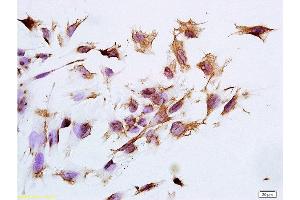 Formalin-fixed and paraffin embedded human epithelial cells tissue labeled with Anti-CK14 Polyclonal Antibody, Unconjugated at 1:300 followed by conjugation to the secondary antibody, (SP-0023), and DAB staining