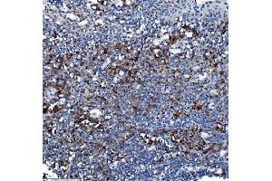 IHC analysis of Liver Carboxylesterase 1/CES1 using anti-Liver Carboxylesterase 1/CES1 antibody (ABIN7602719). (CES1 anticorps  (AA 99-206))