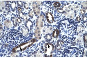 Human kidney; TSFM antibody - N-terminal region in Human kidney cells using Immunohistochemistry (TSFM anticorps  (N-Term))