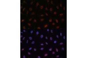 Immunofluorescence analysis of U-2 OS cells using MED25 Polyclonal Antibody (ABIN7268442) at dilution of 1:100 (40x lens). (MED25 anticorps  (AA 30-200))