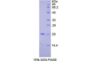 SDS-PAGE analysis of Human FcgBP Protein. (FCGBP Protéine)