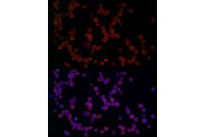Immunofluorescence analysis of THP-1 cells using YKL-40/CHI3L1 Rabbit pAb (ABIN1679214, ABIN1679215, ABIN1679216, ABIN5664234 and ABIN6220124) at dilution of 1:50 (40x lens). (CHI3L1 anticorps  (AA 22-240))