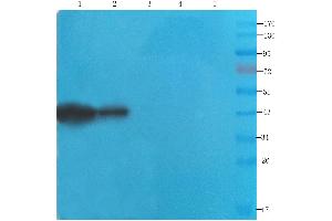 Western Blot using anti-CDCrel-1 antibody ABIN7072252 Rat brain (lane 1), mouse spinal cord (lane 2), rat testis (lane 3), human lung cancer (lane 4) and human breast cancer (lane 5) samples were resolved on a 12 % SDS PAGE gel and blots probed with ABIN7072252 at 2 μg/mL before being detected by a secondary antibody. (Recombinant Septin 5 anticorps)