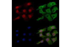 Phospho-TOP2A (Thr1343) Antibody staining Hela cells(heat shock treatment) by IF/ICC. (Topoisomerase II alpha anticorps  (pThr1343))