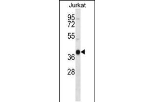 Western blot analysis in Jurkat cell line lysates (35ug/lane). (MARCH4 anticorps  (C-Term))