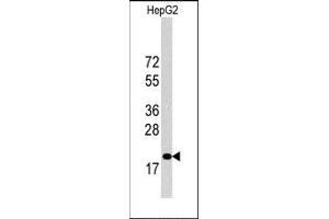 Image no. 2 for anti-Cyclin-Dependent Kinase Inhibitor 1B (p27, Kip1) (CDKN1B) (C-Term) antibody (ABIN358766) (CDKN1B anticorps  (C-Term))