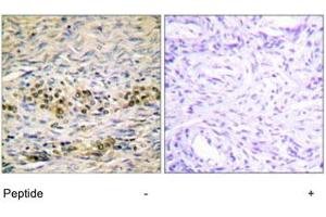 Immunohistochemistry analysis of paraffin-embedded human ovary tissue using AKT1 polyclonal antibody . (AKT1 anticorps)