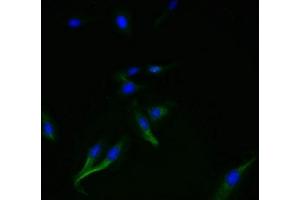 Immunofluorescent analysis of Hela cells using ABIN7169852 at dilution of 1:100 and Alexa Fluor 488-congugated AffiniPure Goat Anti-Rabbit IgG(H+L) (SMIM14 anticorps  (AA 1-49))