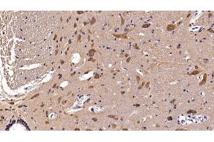 Detection of AST2 in Rat Spinal cord Tissue using Polyclonal Antibody to Aspartate Aminotransferase 2 (AST2) (AST2 (AA 30-430) anticorps)