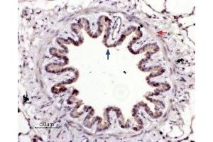Expression of PAR-4 in rat lung - Immunohistochemical staining of rat lung paraffin-embedded sections using Anti-PAR4 (F2RL3) (extracellular) Antibody ((ABIN7043077, ABIN7045106 and ABIN7045107), (1:100).