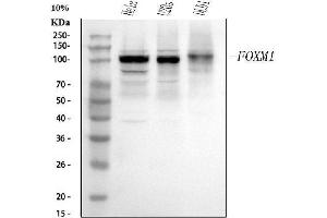 Western blot analysis of FOXM1 using anti-FOXM1 antibody (ABIN7825381).