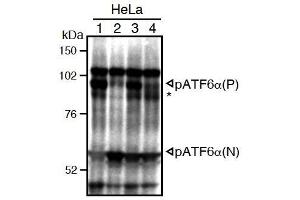 Western Blotting (WB) image for anti-Activating Transcription Factor 6 (ATF6) (N-Term) antibody (ABIN2451923)