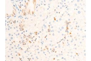 ABIN6255938 and ABIN6267302 at 1/100 staining human liver tissue sections by IHC-P.