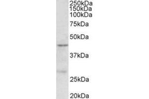 Western Blotting (WB) image for anti-Protein Arginine Methyltransferase 6 (PRMT6) (Internal Region) antibody (ABIN1108736) (PRMT6 anticorps  (Internal Region))