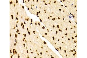 Immunohistochemistry of paraffin-embedded Mouse heart using DiMethyl-Histone H3-K27 Polyclonal Antibody at dilution of 1:100 (40x lens).