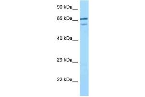 WB Suggested Anti-VILL Antibody Titration: 1. (VILL anticorps  (C-Term))