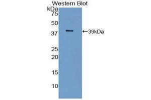 Western Blotting (WB) image for anti-Insulin Receptor (INSR) (AA 1027-1364) antibody (ABIN1859478) (Insulin Receptor anticorps  (AA 1027-1364))