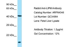Western Blotting (WB) image for anti-Lipase, Family Member M (LIPM) (N-Term) antibody (ABIN2789813) (LIPM anticorps  (N-Term))