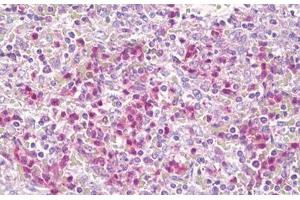 Anti-CSF2RB / CD131 antibody IHC staining of human spleen, neutrophils. (CD131 anticorps  (AA 559-608))