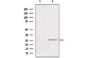 Western blot analysis of extracts from mouse brain, using LGALS3 Antibody. (Galectin 3 anticorps  (Internal Region))