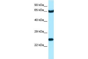 WB Suggested Anti-STXBP3 Antibody Titration: 1. (STXBP3 anticorps  (C-Term))